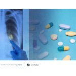 A New Wave of Tuberculosis R&D in Indonesia: Industry Must Stay Alert—Drug Patents Are Heating Up! - AFFA IPR